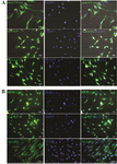 <p>Figure 3. Immunocytochemical staining for specific neural markers in neurogenic differentiated cells (Nestin and MAP2), and GFAP as a marker of astrocyte treated with 1 <em>&mu;M</em> Paroxetine, A) and control group B). In each experiment, the nuclei were counterstained with DAPI. Scale bar=100 <em>&micro;m</em>.</p>
