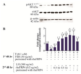 <p>Figure 7. Exogenous SFRP4 differentially modulates PKB/AKT activity in rat granulosa cells (GCs) stimulated with FSH or LH. GCs were treated or pre-treated with rhSFRP-4 (0.5 <em>ng/ml</em>) combined with gonadotropin stimulation. A) The western blot shows a representative result of three independent experiments. B) Quantification was performed using AlphaEaseFC software for densitometric analysis of two independent experiments. &beta;-actin levels were used as an internal control. Data are reported as the mean&plusmn;SD of the fold change relative to untreated cells (set with the arbitrary value of 1.0) (*p&lt;0.05, compared with untreated cells).</p>
