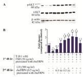 <p>Figure 7. Exogenous SFRP4 differentially modulates PKB/AKT activity in rat granulosa cells (GCs) stimulated with FSH or LH. GCs were treated or pre-treated with rhSFRP-4 (0.5 <em>ng/ml</em>) combined with gonadotropin stimulation. A) The western blot shows a representative result of three independent experiments. B) Quantification was performed using AlphaEaseFC software for densitometric analysis of two independent experiments. &beta;-actin levels were used as an internal control. Data are reported as the mean&plusmn;SD of the fold change relative to untreated cells (set with the arbitrary value of 1.0) (*p&lt;0.05, compared with untreated cells).</p>
