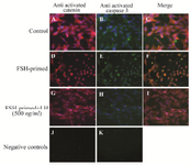 <p>Figure 8. Active &beta;-catenin and cleaved caspase-3 are co-localized in FSH-primed but not LH-stimulated granulosa cells (GCs). Cells were double immunostained with anti-active &beta;-catenin (red) and anti-active casapse-3 (green). DNA was observed by using DAPI (blue). A-C) Cytoplasmic immunostaining of active &beta;-catenin and active caspase-3 in untreated (control) GCs. D-F) Nuclear localization of active &beta;-catenin and active caspase-3 in FSH-primed GCs. G-I) Cytoplasmic immunostaining of active &beta;-catenin and active caspase-3 in LH-stimulated cells. J-K) The negative control was performed by using IgG1 mouse isotypic control as primary antibody. Images are at 200&times; magnification.</p>