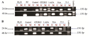 <p>Supplement figure. Representative example of MSP-PCR for pro-motor methylation analysis of ER1 in MDA_MB231 breast cancer cell line.</p>
<p>Positive control: MCF_7 cell line, control: MDA_MB231 cell line. Both cell lines were treated under two conditions (24 <em>hr</em> and 48 <em>hr</em>).</p>
