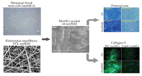 <p>Figure 2. Culture and chondrogenic differentiation of MenSCs on nanoﬁbrous scaffold. The image analyses of the scanning electron microscopy show that cells penetrated and adhered well on the surface of the mesh. Development of cartilage-like tissue in cultured constructs has been examined histologically with respect to the presence of proteoglycan and collagen type II (Scale bar: 100 <em>&micro;m</em>). PCL: Polycaprolactone, Dif: Differentiated, 2D: Two Dimensional. (Adopted from Kazemnejad <em>et al</em> 2014 <sup>40</sup>, with minor modification).</p>

