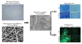 <p>Figure 2. Culture and chondrogenic differentiation of MenSCs on nanoﬁbrous scaffold. The image analyses of the scanning electron microscopy show that cells penetrated and adhered well on the surface of the mesh. Development of cartilage-like tissue in cultured constructs has been examined histologically with respect to the presence of proteoglycan and collagen type II (Scale bar: 100 <em>&micro;m</em>). PCL: Polycaprolactone, Dif: Differentiated, 2D: Two Dimensional. (Adopted from Kazemnejad <em>et al</em> 2014 <sup>40</sup>, with minor modification).</p>
