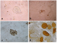 Figure 2. Spermatogonial stem cell detection
(a) The morphology of spermatogonial-derived colony and spermatogonial stem cell proliferation and colonization. (b) C-kit immunoreactivity was positive for the spermatogonial stem cells. (c) Cytokeratin was detected in the neonatal Sertoli cells. (d) Spermatogonial stem cells were positive with monoclonal anti-BrdU antibody in culture medium. Magnification: ×20 (in a), ×40 (in b and c), and ×100 (in d)
