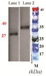 <p>Figure&nbsp; 3. Western blot analysis of L.major CPA and CPB expression in DH5&alpha; using HRP-conjugated anti-His tag polyclonal antibody. Lane 1: Puriﬁed rCPA, lane 2: Puriﬁed rCPB, M: molecular weight marker.</p>