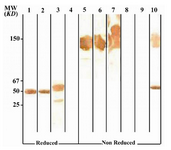 Figure 4. Immunoblot analysis of 2F7G8 MAb (anti-IgG1, 2, 3) reactivity with human IgG subclasses
Lanes 1 to 4 represent reduced forms of IgG1, IgG2, IgG3 and IgG4, respectively. Lanes 5 to 8 represent non reduced forms of the above mentioned proteins, respectively. Lanes 9 and 10 represents Fab and Fc fragments of IgG1, respectively 
