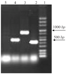 <p>Figure 1. PCR results from right: lane 2, (<em>sulI</em>, 420 <em>bp</em>); lane 3 (<em>smqnr</em> 817 <em>bp</em>); lane 4 (<em>int</em>, 510 <em>bp</em>); lane 5 negative control.</p>