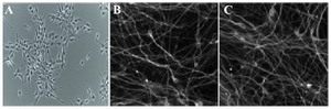 <p>Figure 1. Phase contrast and fluorescence images of cultured and differentiated RenVm cells. RenVm cells at the beginning of the neural differentiation (A). The differentiated RenVm cells four (B) and eight (C) days after the beginning of differentiation. Scale bars represent 200 <em>&micro;m</em> in A and 100 <em>&micro;m</em> in B and C.</p>
