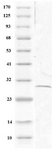 <p>Figure 2. Immunoblotting of CHO cells with transfected inserted plasmids with <em>GRA7</em> genes of&nbsp;&nbsp; <em>T. gondii</em> showed protein with 29 <em>kD</em> molecular weight.</p>