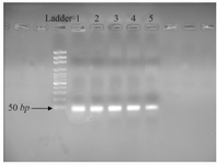 <p>Figure 2. Different concentrations of RT-PCR pruduct of 2% agarose electrophoresis agarose. Line 1: 4000 <em>ng/&micro;l</em>; Line 2: 2000 <em>ng/&micro;l</em>; Line 3: 1000 <em>ng/&micro;l</em>; Line 4: 700 <em>ng/&micro;l</em> and Line 5: 350 <em>ng/&micro;l.</em></p>
