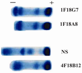 Figure 1. Acetate cellulose electrophoresis of ascitic fluids of 1 F18G7 and 1F18A8 MAbs. NS=Normal serum; 4F18B12= Anti nG1m (a) isoallotype MAb employed as a control 