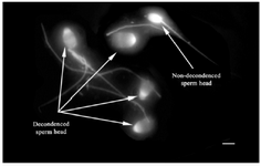 <p>Figure 2. Sperm head decondensation following pretreatment with reducing agents (Bar=5 <em>&micro;m</em>).</p>
