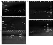 <p>Figure 1. Polymorphism analysis of dihydropyrimidine dehydrogenase (DPYD) and thymidylate synthase (TYMS) polymorphism. A) rs67376798; PCR product digested with BclI; lanes 1,3,5,7 and 9:113+23 <em>bp</em> (Wild type); lanes 2, 4, 6 and 8:136 <em>bp</em> (Undigested control); marker 100 <em>bp</em> (SinaClon, Tehran, Iran). B) rs55886062; PCR product digested with Bsp119I; lanes 1-10: 469+265 <em>bp</em> (Wild type); lanes 11:724 <em>bp</em> (Undigested control) marker 100 <em>bp</em> (Sina-Clon, Tehran, Iran). C) rs 3918290; product digested with Hpy CH4; lanes 1,3,5,7,9,11: 190+54 <em>bp</em> (Wild type); lanes 2,4,6,8,10,12: 244 <em>bp</em> (Undigested control); marker 50 <em>bp</em> (SinaClon, Tehran, Iran). D) rs45445694; lanes 3,9: 276 <em>bp</em> (2 repeat of 28 <em>bp</em> VNTR,2R); lanes 1,4,10: 304 <em>bp</em> (3 repeat of 28 <em>bp</em> VNTR,3R); lanes 2,5,6,7,8: 276+ 304 (2R3R); marker 50 <em>bp</em> (SinaClon, Tehran, Iran). E) TYMS 1494-del TTAAAG; lanes 1,2,10: 60+63 <em>bp</em> (6 <em>bp</em> deletion, del/del); lanes 7,11,12: 123 <em>bp</em> (6 <em>bp</em> insertion,ins/ins) lanes 3-6,8,9: 60+63+123 (ins/del); marker 50 <em>bp</em> (SinaClon, Tehran, Iran).</p>