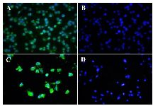 <p>Figure 2. Immunocytochemistry (ICC) assay on bladder carcinoma cell lines. Mouse monoclonal anti-ROR1 antibody 5F1-B10 was used as a primary antibody and FITC-conjugated sheep anti-mouse antibody as secondary antibody (Green). DAPI was used for counterstaining the nucleus (Blue). A (5637 cells), C (EJ138 cells), mouse IgG isotype controls (B and D).</p>