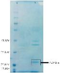 <p>Figure 5. SDS-PAGE of purified-bacteriocin from DDBCC70; 1: weight maker, 2: Bac70 after ammonium sulfate precipitation. The dashed circle shows the Bac70 peptide.</p>