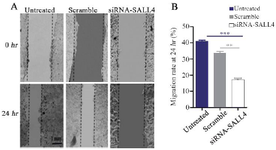 <p>Figure 5. Assessment of MCF-7 cells migration by the scratch assay. Silencing <em>SALL4</em> significantly decreased the migration of MCF-7 cells in comparison with untreated and scrambled transfected cells. The results have been expressed as mean&plusmn;SD (3 repeats) of migration after 24 <em>hr</em> of transfection compared to baseline**: p&lt;0.01.</p>