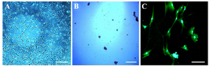 <p>Figure 1. Phase contrast images of cell morphology. Morphological changes were observed in human adipose-derived stem cells (hA DSCs) during oligodendrocyte differentiation. Cultured hADSCs in passage three (A), embryoid body formation (B) and oligodendrocyte differentiation at the end of differentiation process (C). Scale bars represent 200 <em>&micro;m</em> in A, B, and 1000 <em>&micro;m</em> in C.</p>