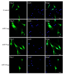 <p>Figure 3. Immunostaining of differentiated cells. Differentiated cells were stained with anti Olig2. DAPI was used for nuclear counterstaining (blue) in order to show all the cells. Increased expression of Olig2 in 5 <em>ng/ml</em> astaxantin treated group was noted. Scale bar=200 <em>&micro;m</em></p>