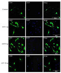 <p>Figure 4. Immunostaining of differentiated cells. Differentiated cells were stained with anti A2B5. DAPI was used for nuclear counterstaining (blue) in order to show all the cells. Increased expression of A2B5 in 5 <em>ng/ml</em> astaxantin treated group was noted. Scale bar=200 <em>&micro;m.</em></p>