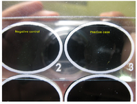 Figure 3. Latex agglutination of Trichomonas vaginalis harvested from culture medium and ploysteren coated purified antibody in comparison with negative control