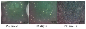 <p>Figure 1. Morphology of the primary culture of adipose-derived stem cells observed by inverted microscope (magnificent 100x). P0 Day 2: ASCs were fibroblast cell like and attached in well; P0 Day 5: ASCs had been proliferated; P0 Day 12: ASCs had proliferated and confluent.</p>
