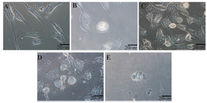 <p>Figure 3. Morphological features of adipose-derived stem cells (ASCs) after 4 <em>hr</em> induction using phase-contrast, inverted microscope (magnificent 400 x).</p>
<ol type="A">
<li>Control cells (without treatment) showing spindle-shape, fibroblast-like morphology;</li>
<li>Cells treated with liposomal SPC extract 1000 <em>ppm</em> showing rounded cells, an early feature of apoptosis;</li>
<li>Cells treated with liposomal purified PC 1000 <em>ppm</em> also showing rounded cells;</li>
<li>Cells treated with PC+SD solution (Dermastabilon<sup>TM</sup>) showing some rounded cells, retracted cells, and cells with disrupted membrane</li>
<li>Cells treated with SD only showing a damaged cell.</li>
</ol>