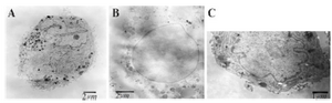 <p>Figure 4. Transmission-electron microscopy of adipose-derived stem cells after induction of apoptosis.</p>
<ol type="A">
<li>cells treated with liposomal SPC extract showing early sign of apoptosis with nucleus nearly fragmented</li>
<li>cells treated with sodium deoxycholate showing extensive membrane damage with vesicular nucleus and disperse chromatin</li>
<li>control cells without treatment showing intact membrane, normal nucleus and nucleolus.</li>
</ol>
