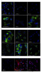 Figure 2. Immunocytochemistry (ICC) assay using 5 ug of affinity-purified anti-nestin (4G10G8). FITC-conjugated sheep anti-mouse antibody was used as secondary antibody. DAPI was used for staining the nucleus (blue). The green fluorescence represents nestin expressed in cytoplasm and the blue color re-presents the nucleus. A) Human cancer cell lines. B) Cell lines derived from other species and also a primary sertoli cells. C) To confirm the ICC results, a negative (CHO), a strong positive (bovine sertoli cells), and a weak positive nestin expressing cells were stained with anti-nestin 4G10G8 conjugated with Alexa Fluor 568 (Invitrogen). Red immunofluorescence re-presents nestin