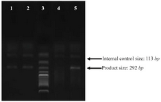 <p>Figure 1. PCR products from various samples. Lane 3: ladder, lane 4: internal control only, lane 1, 2, 5: PCR products from three samples with C alleles.</p>