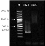 <p>Figure 2. Amplification of HK-1 by specific primers in PCR: M 1 <em>kb</em> DNA marker, lane 1 HK-1, lane 2 negative control.</p>