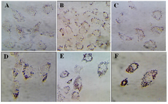 <p>Figure 2. The effects of different doses of <em>Anethum graveolens L.</em> (dill) seed aqueous extract on lipid droplets content of cultured gra-nulose cells of mice, oil red staining, &acute;100 magnification. A) Control culture, B) 10 <em>&mu;g/ml</em>, C) 50 <em>&mu;g/ml</em>, D) 100 <em>&mu;g/ml</em>, E) 500 <em>&mu;g/ml</em> and F) 1000 <em>&mu;g/ml</em> of <em>Anethum graveolens L</em> extract treated culture.</p>