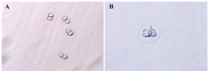 <p>Figure1. 2-cell embryo (A) before freezing and (B) while freezing (magnified &times;100). 337.</p>