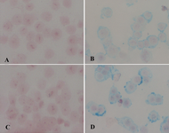 Figure 4. Iron staining of cells after incubation with conjugated nanoparticles A: SKBR3 cells, B: KBR3 with iron staining, C: T47D cells, D: with iron staining. 