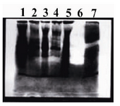 Figure 5. The cell lysate of transformed expression host before and after induction were applied to evaluate the activity and conformation of recombinant t-PA. Lane 7 shows the transparent band of cell lysate after induction, which indicated that the plasminogen is digested by serine-protease activity of t-PA and derived plasmin resulted in gelatin hydrolysis. Commercial t-PA (Actylase) was used as positive control (Lanes 6). Cell lysate of transformed expression host before induction (Lane 5) and negative colonies (Lanes1-4) after induction were used as negative controls