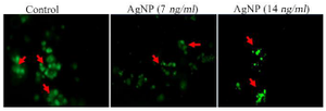 <p>Figure 3. Cell viability analysis by calcein AM staining. Red arrow showing green fluorescence indicates the viable cells.</p>