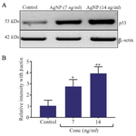 <p>Figure 6. A) Western blot analysis of p53 expression. B) Quantification of p53 protein expression by densitometry analysis, n=3, *p&lt; 0.05 and ** p&lt;0.01 <em>vs.</em> control.</p>