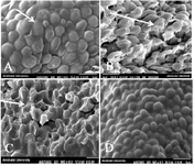 <p>Figure 1. SEM images of C. glabrata treated with silver nanoparticles; 9000&times;magniﬁcation</p>
<ol>
<li>A) Untreated <em> glabrata</em>; the white arrow indicates the smooth cell membrane of normal yeast.</li>
<li>B) <em> glabrata</em> treated with 0.5 <em>&micro;g/ml</em> Ag-NPs.</li>
<li>C) <em> glabrata</em> treated with 0.5 <em>&micro;g/ml</em> Se-NPs.</li>
<li>D) <em> glabrata</em> treated with 0.5 <em>&micro;g/ml</em> Au-NPs.</li>
</ol>