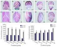 <p>Figure 2. Reduction in cortical thickness and dilatation of lateral ventricles in the control and Tio<sub>2</sub>-NPs exposed embryos on E16 (A1-E1) and E19 (A2-E2). Heads of control and exposure groups were transversely sectioned and stained with H&amp;E. Decreased cortical thickness and lateral ventricular dilatation after nanoparticle exposure increased significantly (p&lt;0.05) at higher doses (300 and 500 <em>mg/kg</em>) compared with control. Data are presented as mean&plusmn;SD. # comparison with control on E16 and * E19.</p>