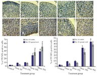 <p>Figure 4. Photomicrographs of TUNEL-stained sections of fetuses in cortex (A1-E1) and spinal cord (A2-E2) on E19. The apoptotic cells were predominant in Tio<sub>2 </sub>NPs groups compared to the control group. The number of TUNEL-positive cells (Red arrow) was significantly higher in the 300 and 500 <em>mg/kg</em> groups than in the control group, # comparison with control on E16 and * E19.</p>