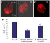<p>Figure 1. Staining of blastocysts derived from <em>in vivo</em> condition (A) and <em>in vitro</em> matured germinal vesicle oocytes in the absence (SS-; B) and presence of Sodium Selenite (SS+; C). The comparison of total cell number of blastocysts in previous groups was shown in part D. Letter a indicated the differences of each group with the control group and letter b showed significant differences between Sodium Selenite treated group with non-treated group (p&lt;0.05).</p>