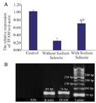 <p>Figure 2. The relative expression of <em>TFAM </em>&nbsp;and &beta;-actin in MII oocytes obtained from <em>in vivo </em>and <em>in vitro</em> conditions in the presence and absence of Sodium Selenite (A). a: significant differences with <em>in vivo</em> group; b: significant differences with non-treated <em>in vitro</em> group (p&lt;0.05). The representative figure of gel electrophoresis of PCR product in studied groups (B). No template control (NTC).</p>