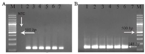 <p>Figure 2. A) Analysis of the sensitivity of conventional PCR for <em>F. tularensis fopA</em> gene in 1.5% agarose gel stained by ethidium bromide. Lane (M) 100 <em>bp</em> DNA marker, lane (1) negative control, lane (2) 10 <em>ng</em> of DNA, lane (3) 1 <em>ng</em> of DNA, lane (4) 100 <em>pg</em> of DNA, lane (5) 10 <em>pg</em> of DNA, lane (6) 1 <em>pg</em> of DNA, lane (7) 0.1 <em>pg</em> of DNA . B) Analysis of&nbsp; the sensitivity of the PCR reaction for <em>Ebola </em>virus in 1.5% agarose gel stained by ethidium bromide. Lane (1) 10 <em>ng</em> of DNA, lane (2) 1 <em>ng</em> of DNA, lane (3) 100 <em>pg</em> of DNA, lane (4) 10 <em>pg</em> of DNA, lane (5) 1 <em>pg</em> of DNA, lane (6) 0.1 <em>pg</em> of DNA, lane (7) negative control and lane (M) 100 <em>bp</em> DNA marker.</p>