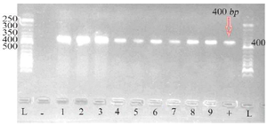 <p>Figure 1. Gel electrophoresis of PCR product of <em>pbo1</em> gene from several <em>P. aeruginosa</em> isolates along with the standard 50-<em>bp</em> marker (1-9: Samples; L: Ladder; +: Positive control; -: Negative control).</p>