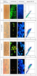 <p>Figure 2. In control group during DAPI staining, the intact nucleus showed that the cells were healthy. In the cisplatin and Fisetin groups, A2780 cells underwent apoptosis after 24 <em>hr</em> of treatment and the cell nuclei were fragmented, and the rate was higher in the combined group. AO/PI staining: The number of apoptotic (Red) cells in the combined group is higher than the groups treated with either cisplatin or Fisetin (Magnification&times;10). The results of Annexin V-FITC/PI assay show that in the combined group, induction of apoptosis in cells under treatment was much more effective than the use of either Fisetin or cisplatin.</p>