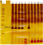 <p>Figure 4. <em>BRAF</em> gene polyacrylamide gel. Lane1: 100 <em>bp</em> marker, Lane 2 to Lane 6: mutant alleles, and Lane 7 to Lane 11: non-mutant alleles. It is interpreted as meaning that the first sample has a mutation and the other three samples do not have a mutation. Lane 6 and 11 are PCR (M.M) mixture contamination controls.</p>