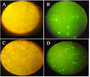 <p>Figure 2. For evaluation of transfection efficiency, GFP expression was detected using fluorescence microscopy. A) Light and B) fluorescence microscopy images of transfected cells with MTDH shRNAs, C) Light and D) fluorescence microscopy images of control cells that were transfected with scrambled shRNA plasmid.</p>