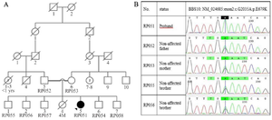 <p>Figure 1. Pedigree and sequencing data of the family. A) This pedigree displays a BBS patient from a consanguineous marriage who is the only one affected in her family, B) As shown in chromatograms, proband was homozygous for c.2035G&gt;A mutation and inherited mutation from both carrier parents. Also, two normal brothers (RP055 and RP056) who participated in this study were carriers of mutation.</p>