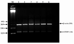 Figure 5. Effect of lentinan on hTERT gene expression (Lanes 1 through 6 represent 0, 2, 4, 6, 8 and 10 ug/ml lentinan concentrations at which DLD-1 gastric cancer cell lines were incubated; M is molecular weight marker)