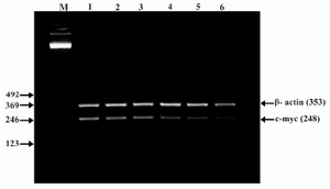 Figure 6. Effect of lentinan on C-myc gene expression (Lanes 1 through 6 represent 0, 2, 4, 6, 8 and 10 ug/ml lentinan concentrations at which DLD-1 gastric cancer cell lines were incubated; M is molecular weight marker)