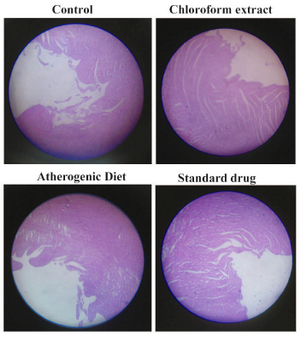 Figure 2. Histopathological sections of aorta
(Atherogenic- atheromatous thickening intima)
